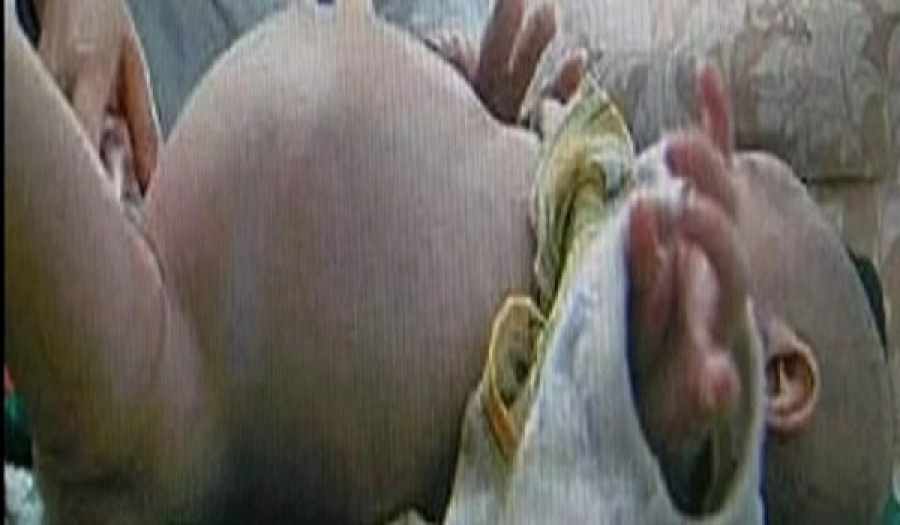 Σοκ στην Κίνα: Η κοιλιά αυτού του μωρού άρχισε να φουσκώνει – Όταν μάθαμε την αιτία σοκαριστήκαμε! (vid)